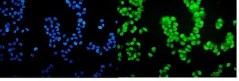 Progesterone Receptor/PGR Rabbit Polyclonal Antibody