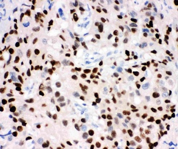 Progesterone Receptor/PGR Rabbit Polyclonal Antibody