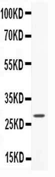 CNTF Rabbit Polyclonal Antibody