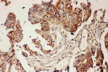 CNTF Rabbit Polyclonal Antibody