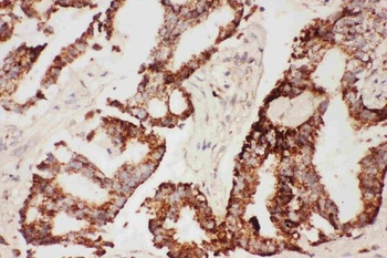 CNTF Rabbit Polyclonal Antibody