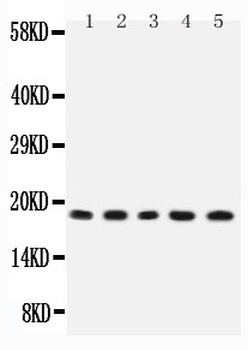 IL2 Antibody