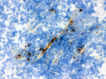 Actin ACTA1 Mouse Monoclonal Antibody