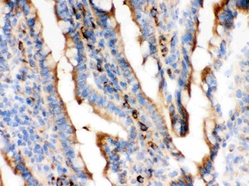 Actin ACTA1 Mouse Monoclonal Antibody