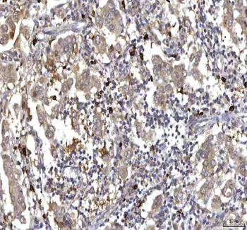 RASGRP3 Antibody