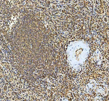 SMIM8 Antibody