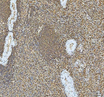SMIM8 Antibody