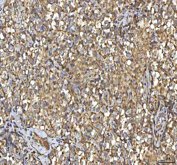 SMIM8 Antibody