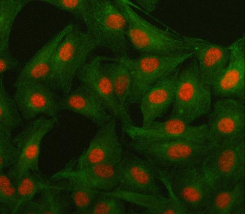 Islet 1/ISL1 Antibody