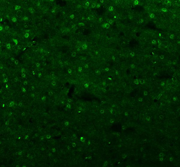 Islet 1/ISL1 Antibody