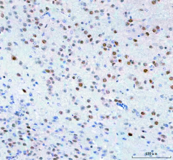 Islet 1/ISL1 Antibody