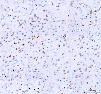 Islet 1/ISL1 Antibody