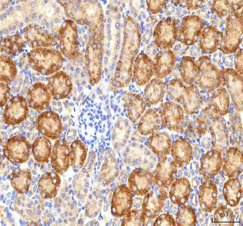HSDL2 Antibody