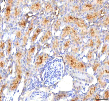 HSDL2 Antibody
