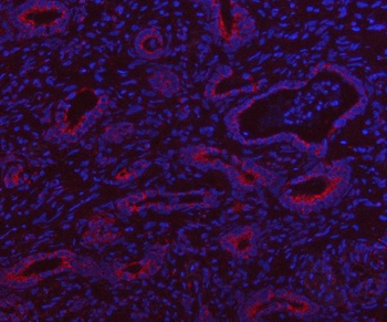HSDL2 Antibody