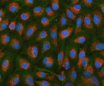 HSDL2 Antibody
