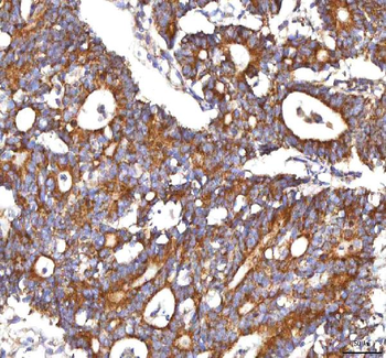HSDL2 Antibody