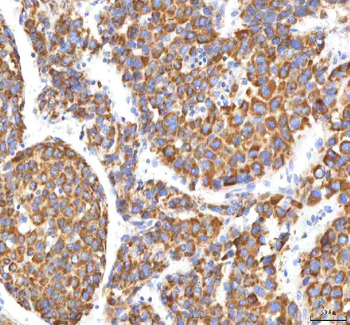 HSDL2 Antibody