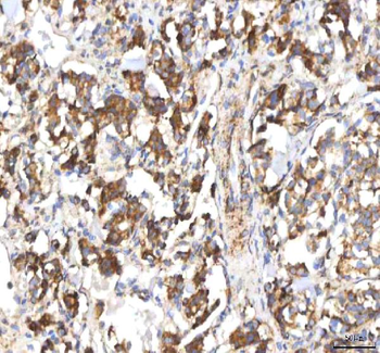 HSDL2 Antibody