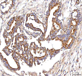 HSDL2 Antibody