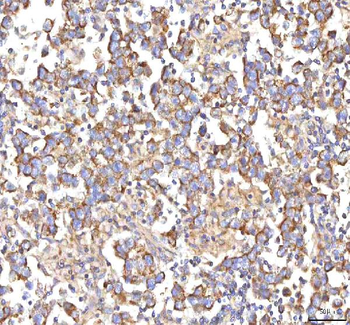 HSDL2 Antibody