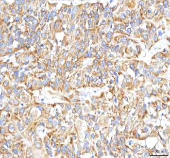 HSDL2 Antibody