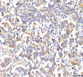HSD17B13 Rabbit Polyclonal Antibody