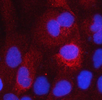 HSD17B2 Rabbit Polyclonal Antibody