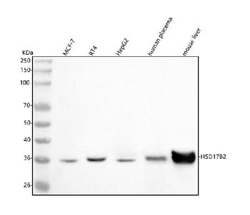 HSD17B2 Rabbit Polyclonal Antibody