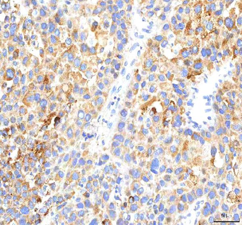 HEPACAM2 Rabbit Polyclonal Antibody