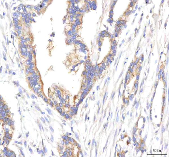 HEPACAM2 Rabbit Polyclonal Antibody
