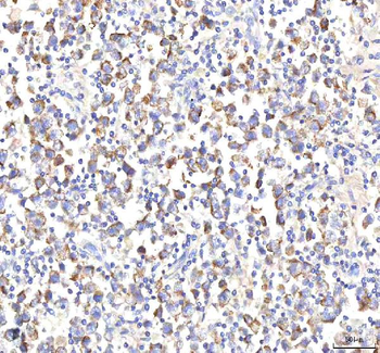 HEPACAM2 Rabbit Polyclonal Antibody
