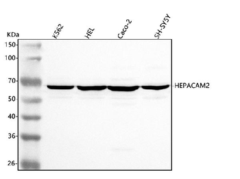 HEPACAM2 Rabbit Polyclonal Antibody
