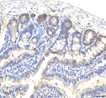 ITPA Antibody