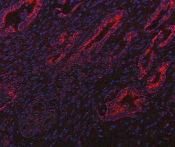 ITPA Antibody
