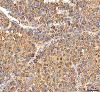 ITPA Antibody