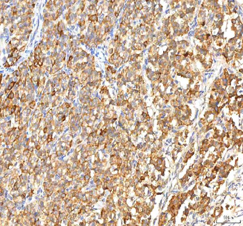 ITPA Antibody