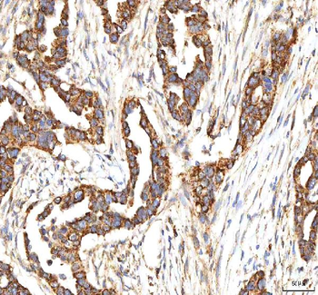 ITPA Antibody