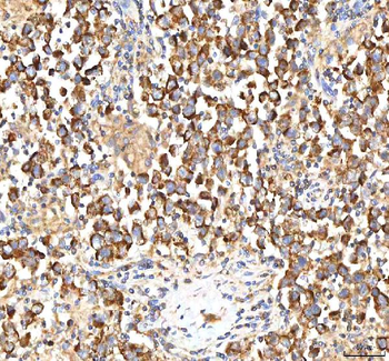 ITPA Antibody