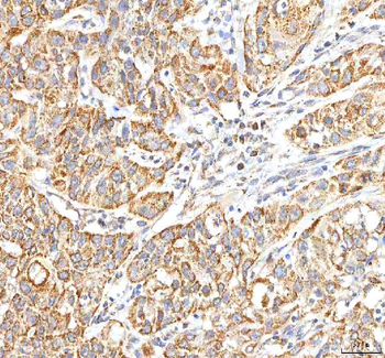 ITPA Antibody