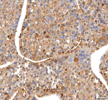 ISYNA1 Antibody