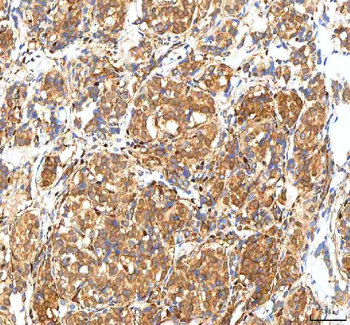 ISYNA1 Antibody
