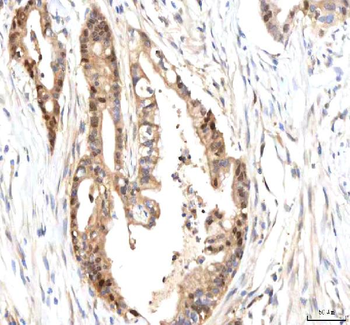 ISYNA1 Antibody