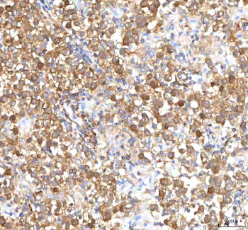 ISYNA1 Antibody