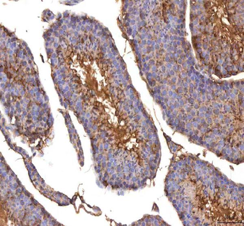 ISYNA1 Antibody