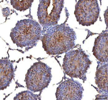 ISYNA1 Antibody
