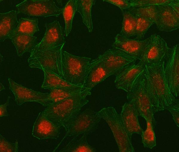 IRF5 Rabbit Polyclonal Antibody