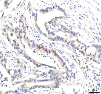 IPO8 Rabbit Polyclonal Antibody