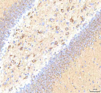 Calreticulin/CALR Antibody