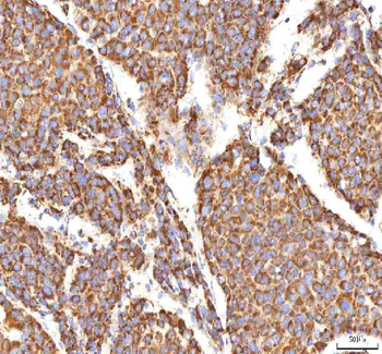 Calreticulin/CALR Antibody